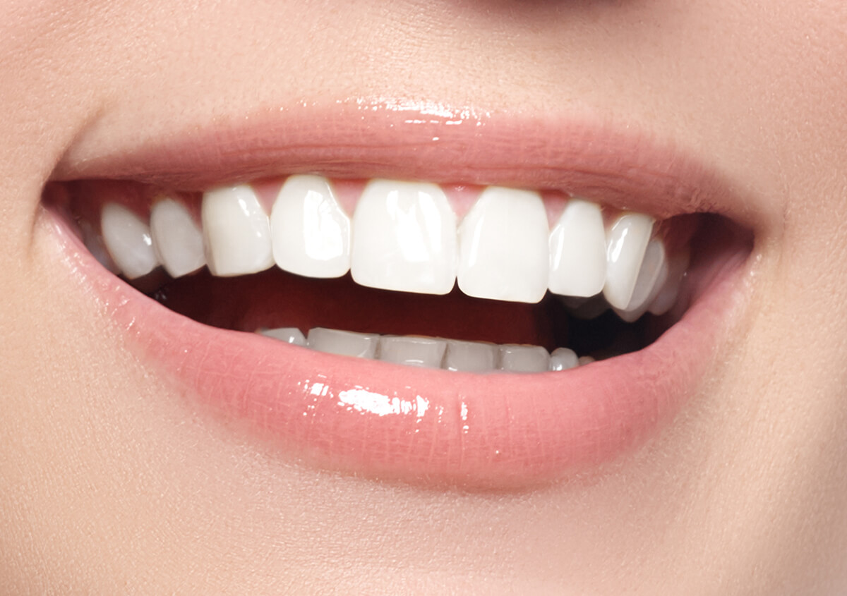 Effective Teeth Whitening in Wayne IN Area